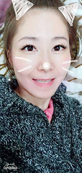 【醫美保養】* 佳思優整形醫美診所*第三代海芙音波拉提+肉毒除皺 *歲月是把殺豬刀*音波拉提保養做好逆齡水嫩膨膨肌(12.15更新照片) @💕小美很愛嚐💕 【醫美保養】* 佳思優整形醫美診所*第三代海芙音波拉提+肉毒除皺 *歲月是把殺豬刀*音波拉提保養做好逆齡水嫩膨膨肌(12.15更新照片) @💕小美很愛嚐💕