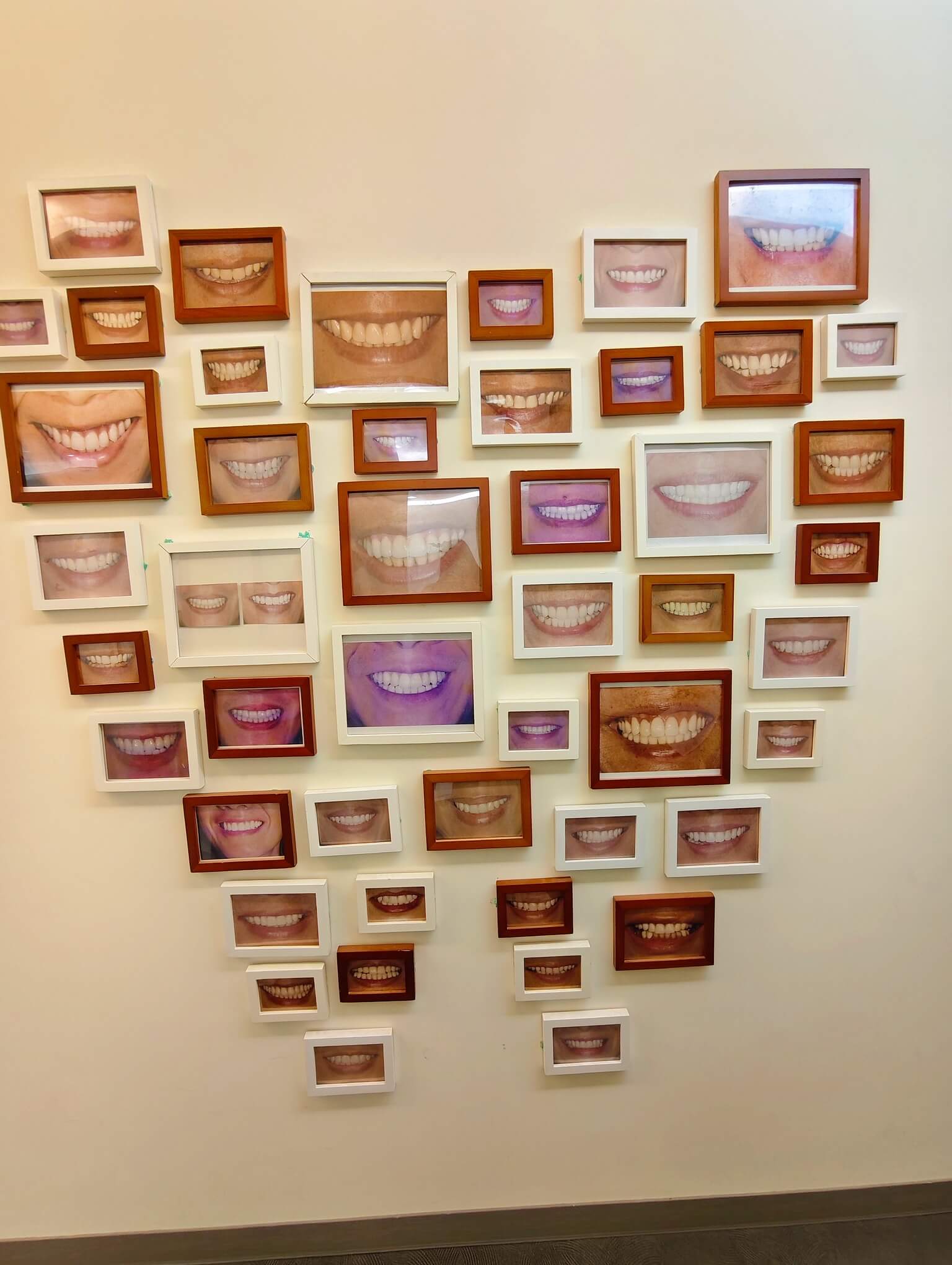 新竹牙醫推薦｜品御牙醫診所、帶你告別傳統補牙、3D齒雕諮詢、優缺點、材質、治療流程一次了解！！