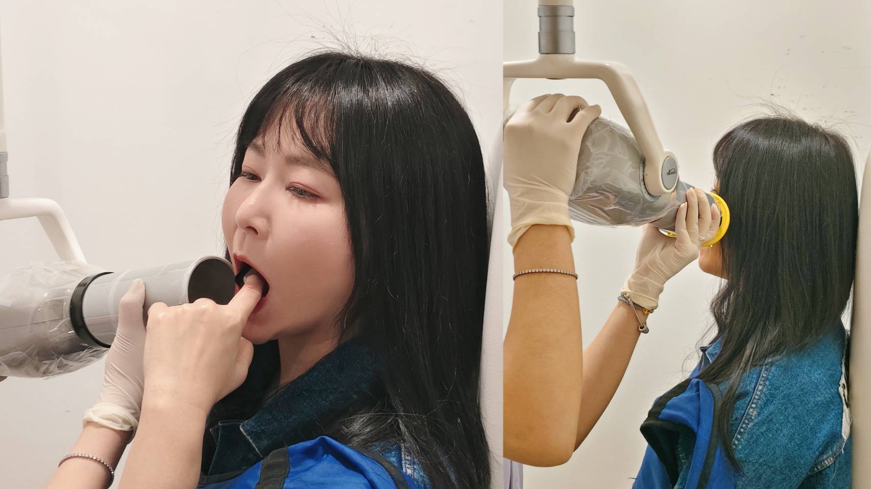 新店牙醫推薦|玉美學牙醫診 3D齒雕諮詢、優缺點、材質、治療流程一次了解! - 第10張圖 新店牙醫推薦|玉美學牙醫診 3D齒雕諮詢、優缺點、材質、治療流程一次了解!